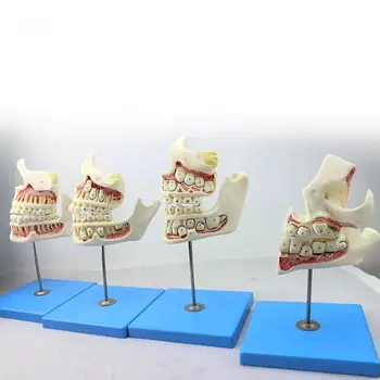 Задайте Етап на развитие на човека От млечните до постоянни зъби Зъболекар на устната кухина Модел стоматолог хирург на Медицински образователни модели